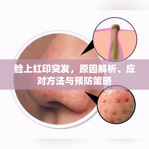 脸上红印突发，原因解析、应对方法与预防策略